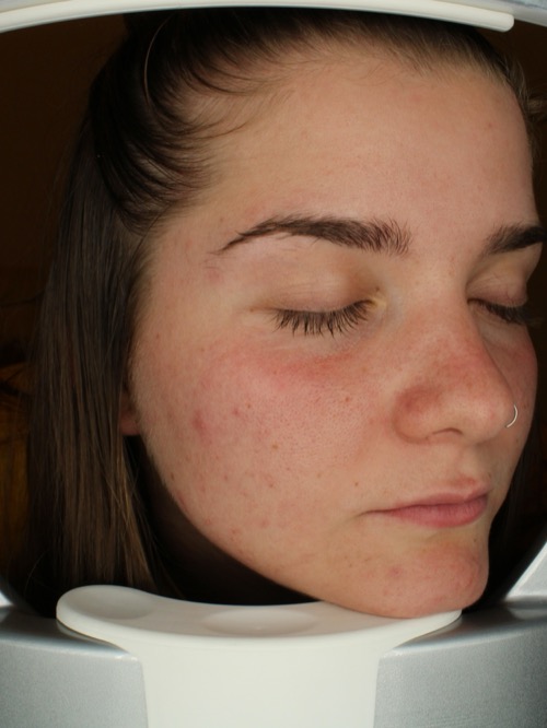 Before refiner treatment