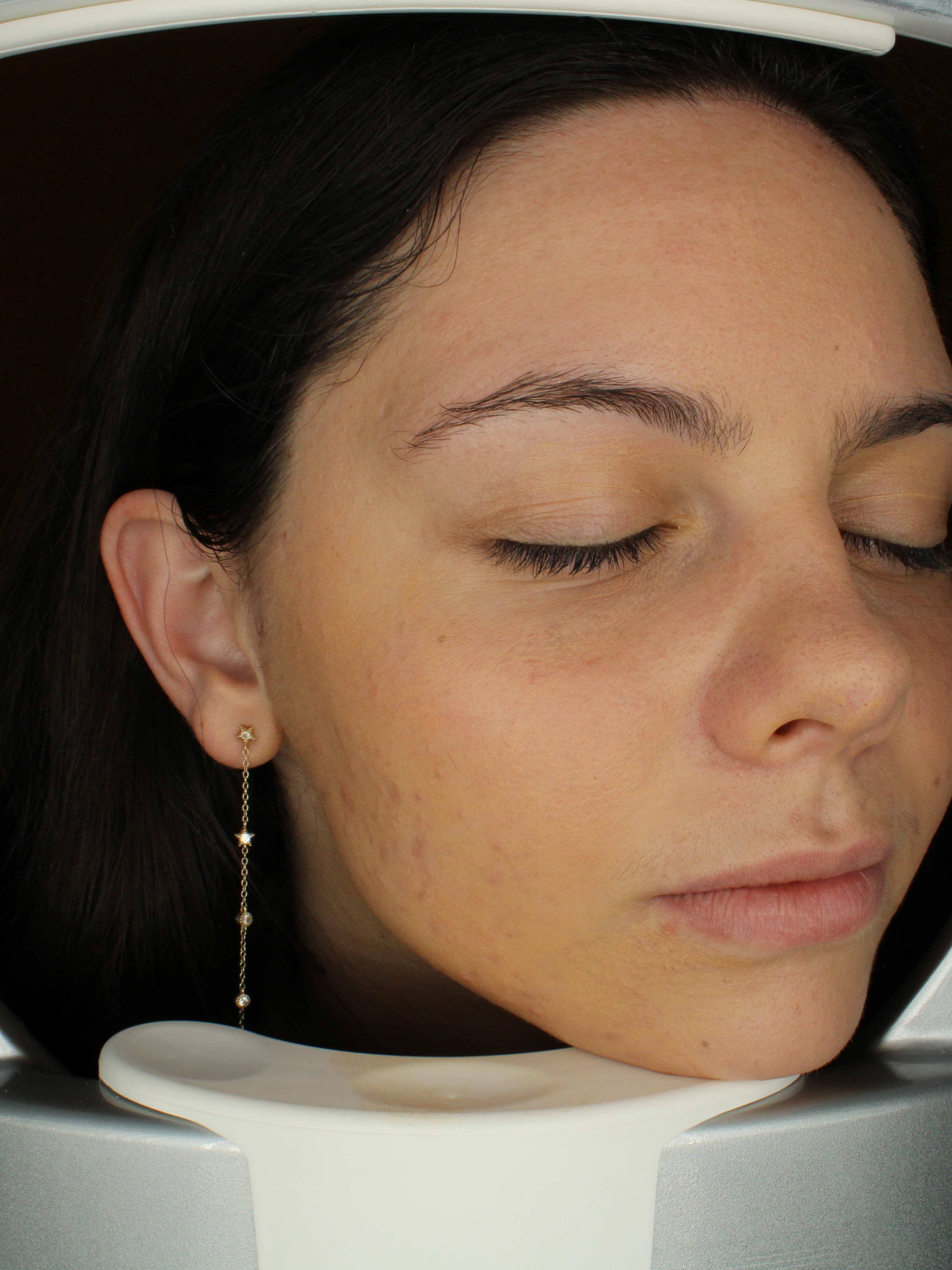 Pore Refining - After
